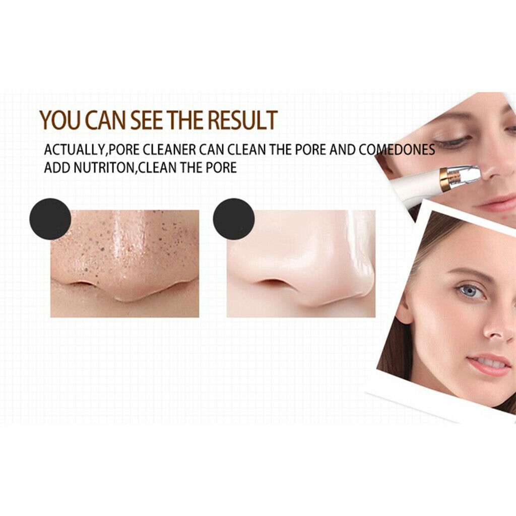 Strong Suction Blackhead Acne Comedo Whitehead Remover Face Skincare Device