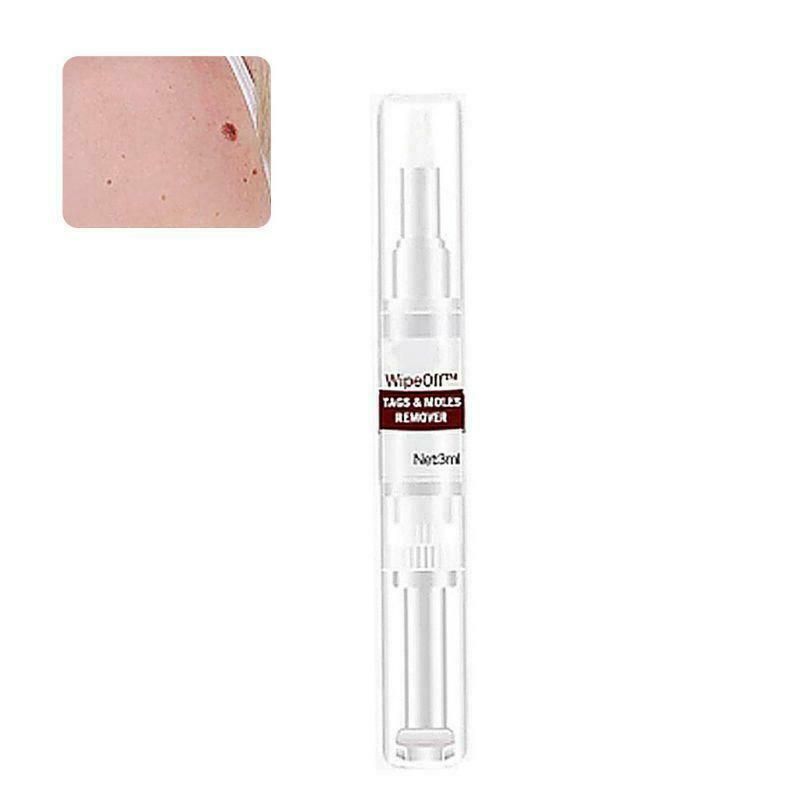 10ml Skin Tags Moles Remover Pen Facial Body Wart Dark Spot Treatment Liquid
