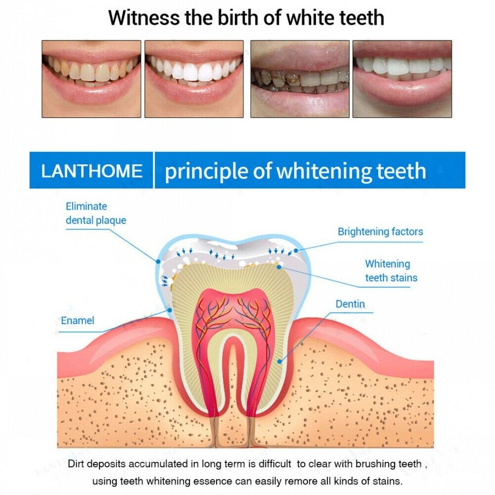 For men and women teeth whitening Dental care pen portable oral care suitable