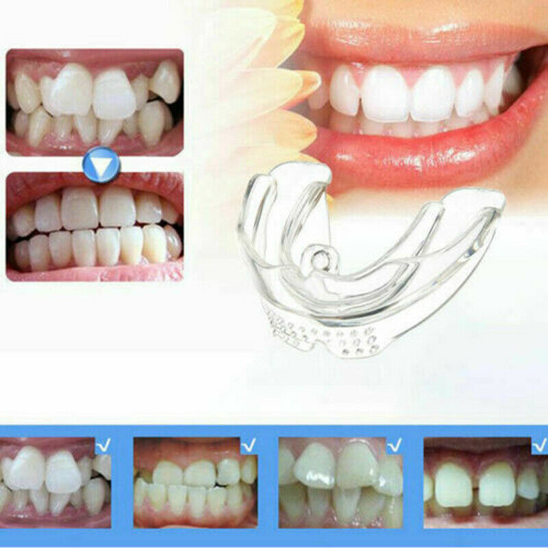Dental Orthodontic Teeth Corrector Braces Tooth Retainer Straighten