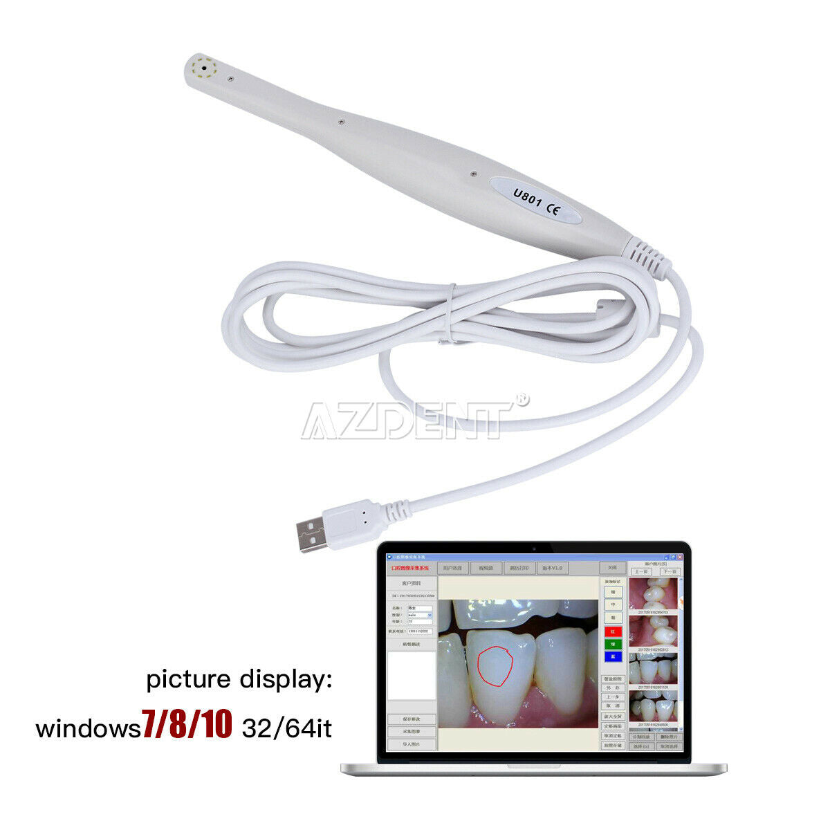 Digital Dental USB Intraoral Camera 8 White Cold Light LEDs 1/4 CMOS Sensor New