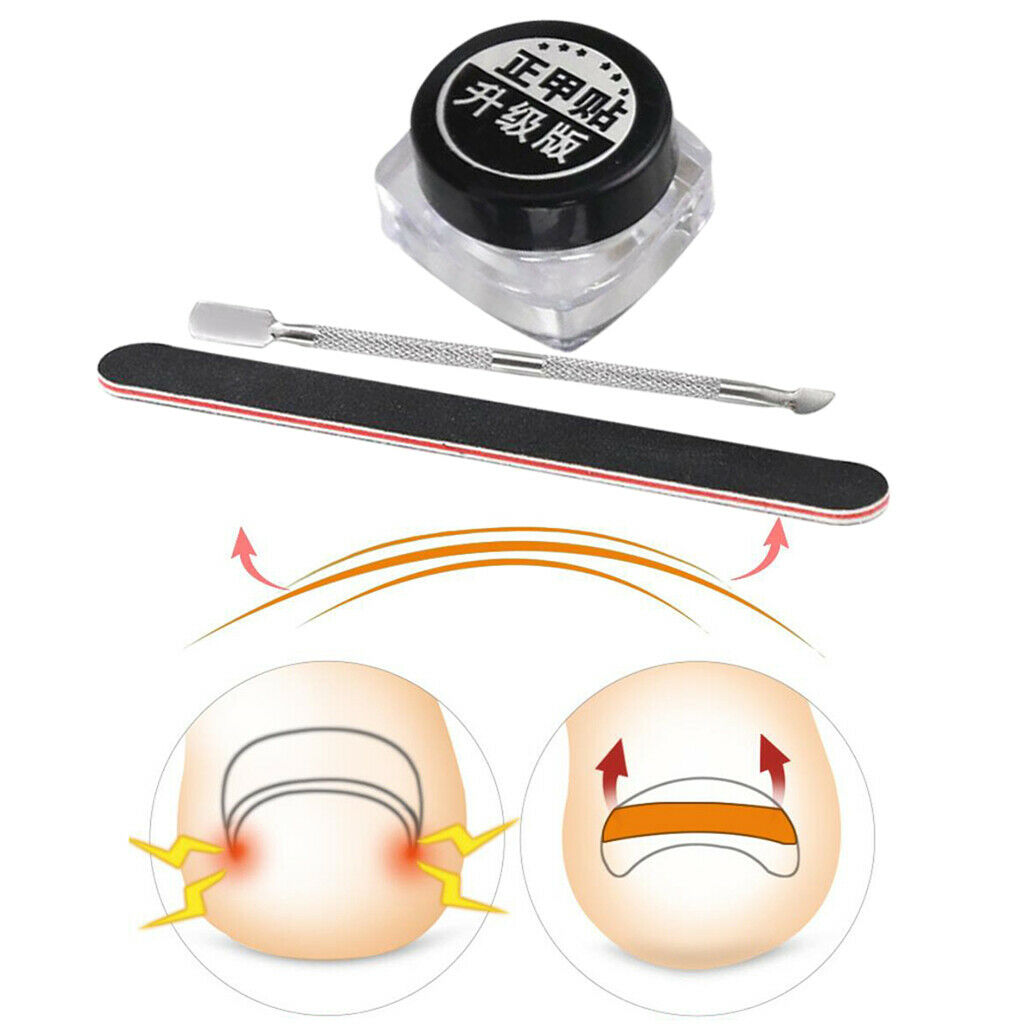 Ingrown Toenail Corrector Stickers Tape w/Pusher Nail File Set Pain Ease