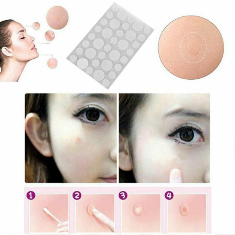 36PCS Fast Remover Pimple Patch Treatment Acne Patch Skin Tag Beauty Make.l8