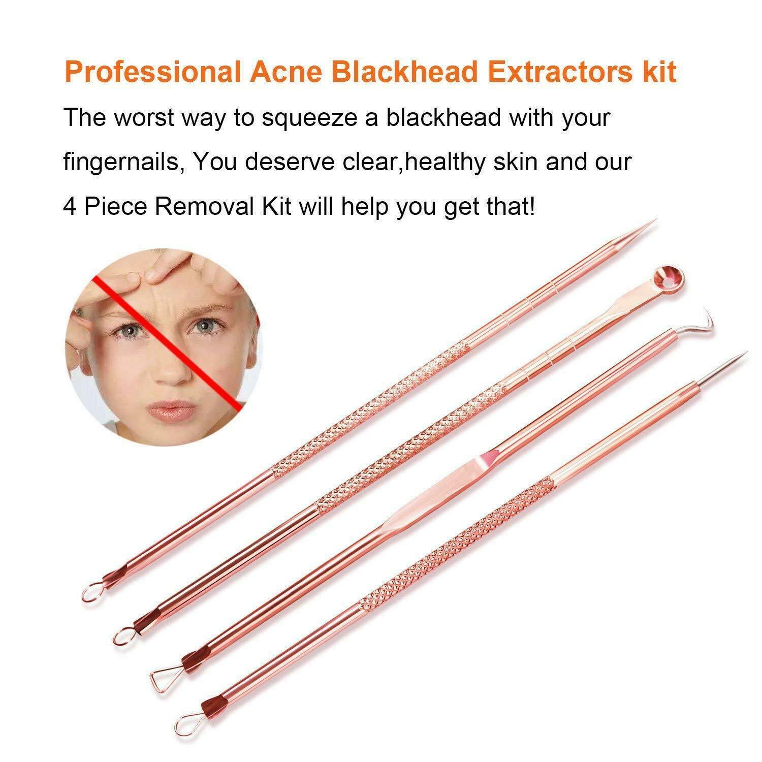 4pcs/Set Blackhead Acne Comedone Pimple Blemish Extractor Remover Tool Kit Set