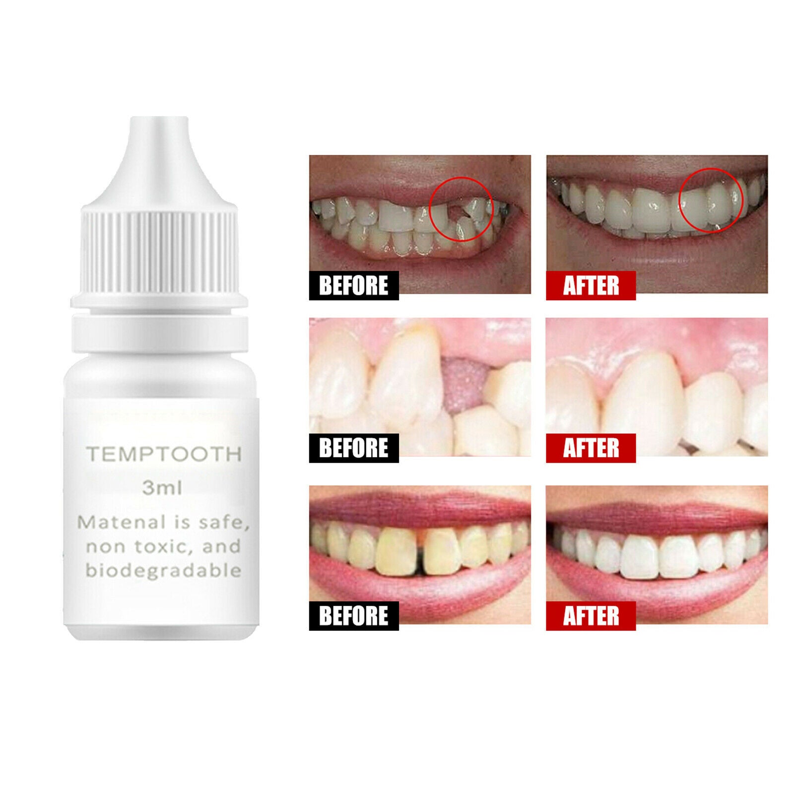 Dental 3ml Moldable Thermal Beads Denture Temporary Teeth Repair Kit Beads