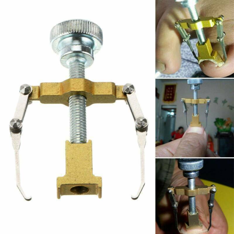 Ingrown Toe foot Nail Correction Fixer Nail Pedicure Tool Toenail Corrector US