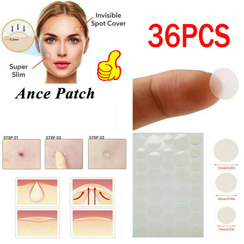 36 Patches Anti Acne Pimple Patch Face Skin Spot Scar Care Treatment Stickers ..