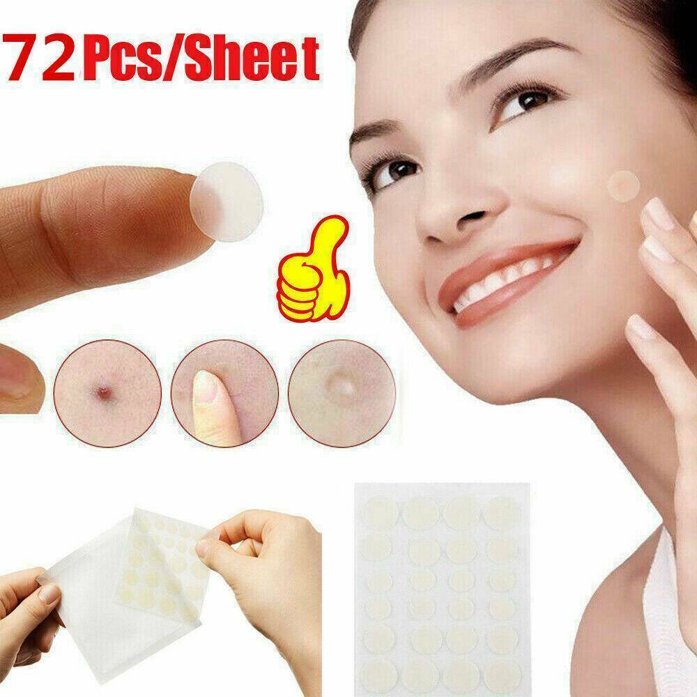 72PCS DERMOPATCHY ACNE SKIN TAGS PIMPLE REMOVER PATCH REMOVAL FACIAL CARE SPOT !