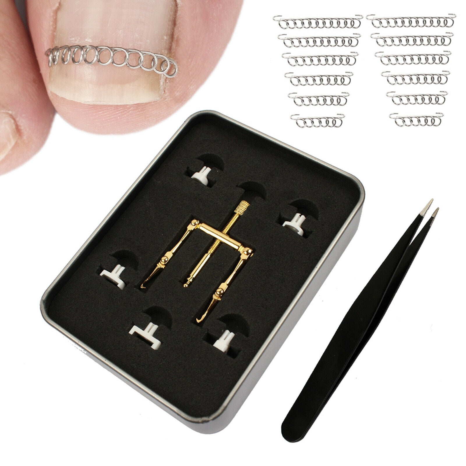 Portable Ingrown Toenail Correction Nail Lifter Clamp Foot Pedicure Tool