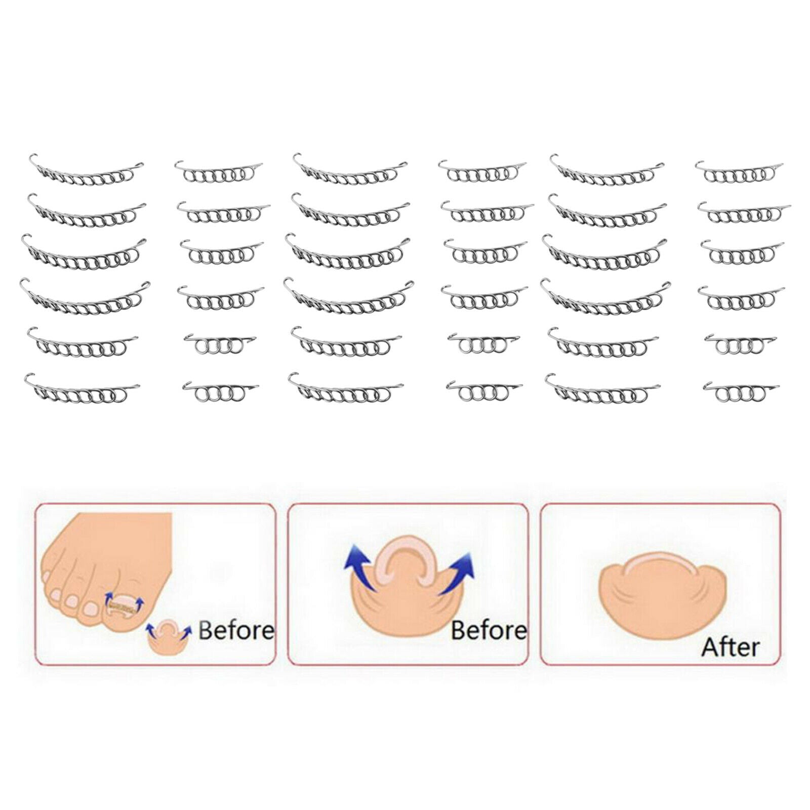 36pcs 3 box Bunion Toenails Correction Wire Fixer Wire Recover Care Nail Art