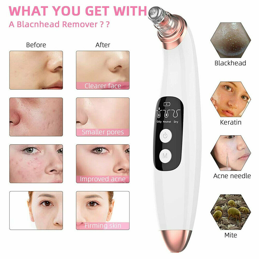 Visible Electric Blackhead Remover with Camera Derma Vacuum Pore Cleaner Suction