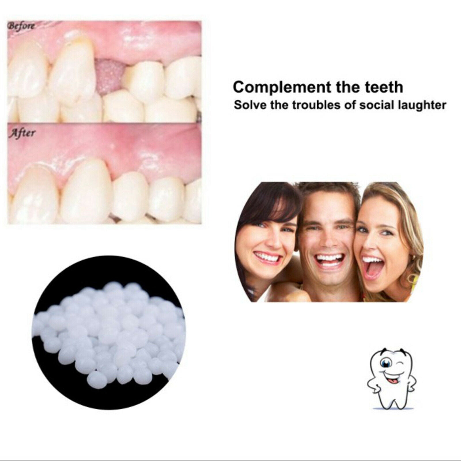 Thermal Tooth Filler Beads for Temporary Tooth Fix Missing Teeth or Brokens