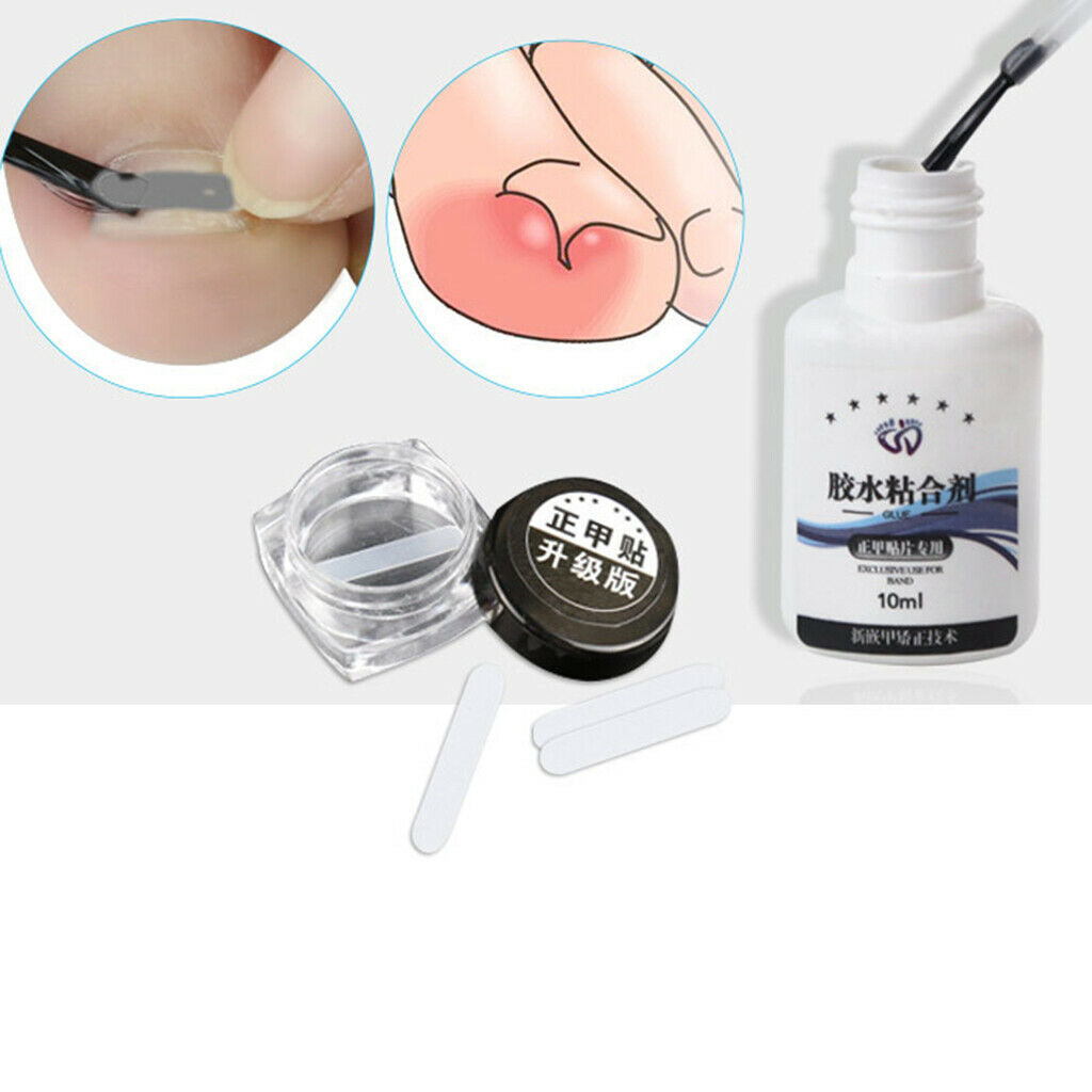 Strong Ingrown Toenail Set Supplies Tools for Nail Correction Men Women