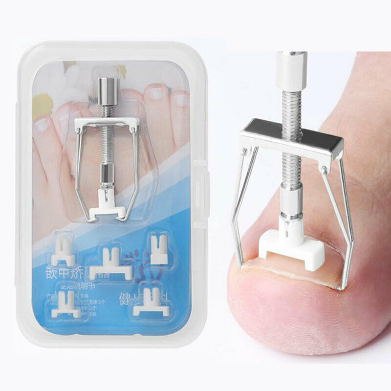 New Ingrown Toe Na Fixer Pedicure Recover Embed Toenail Correction Lifter USSJC