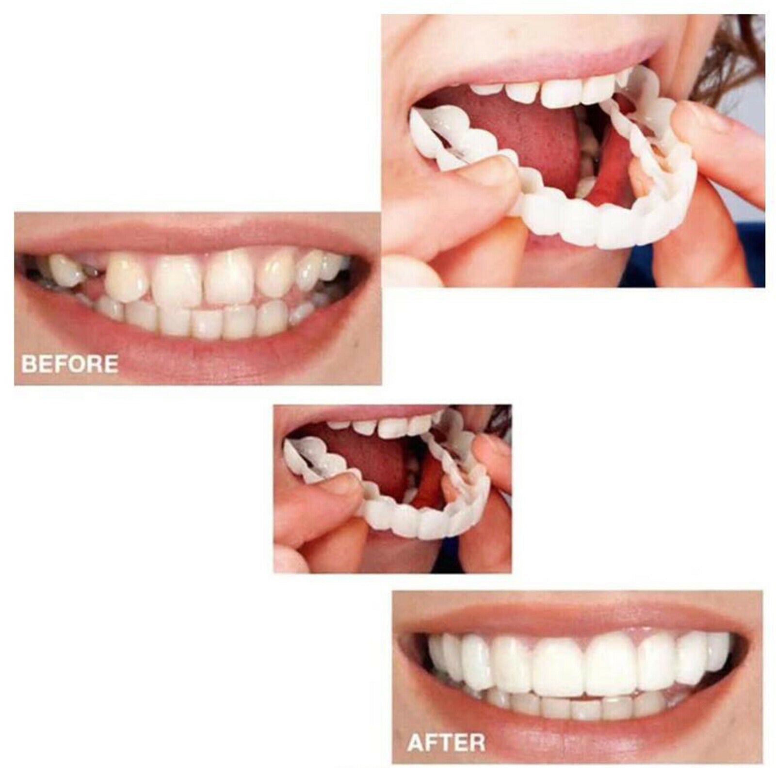Smiling Snap False Teeth Veneers Cosmetic Tooth Cover Simulation Braces