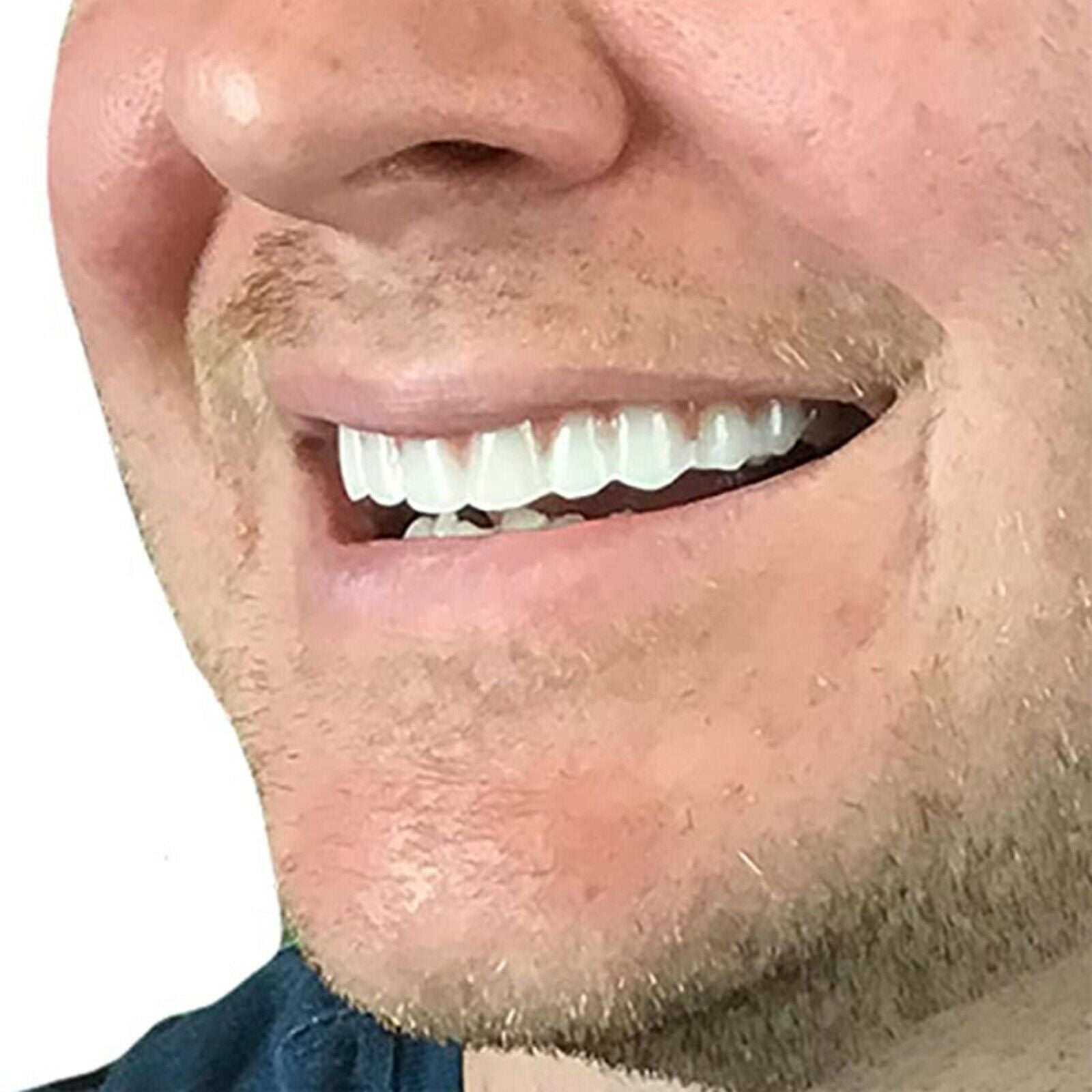 Professional Cosmetic Upper Teeth - New from Instant Smiling! Hand Crafted