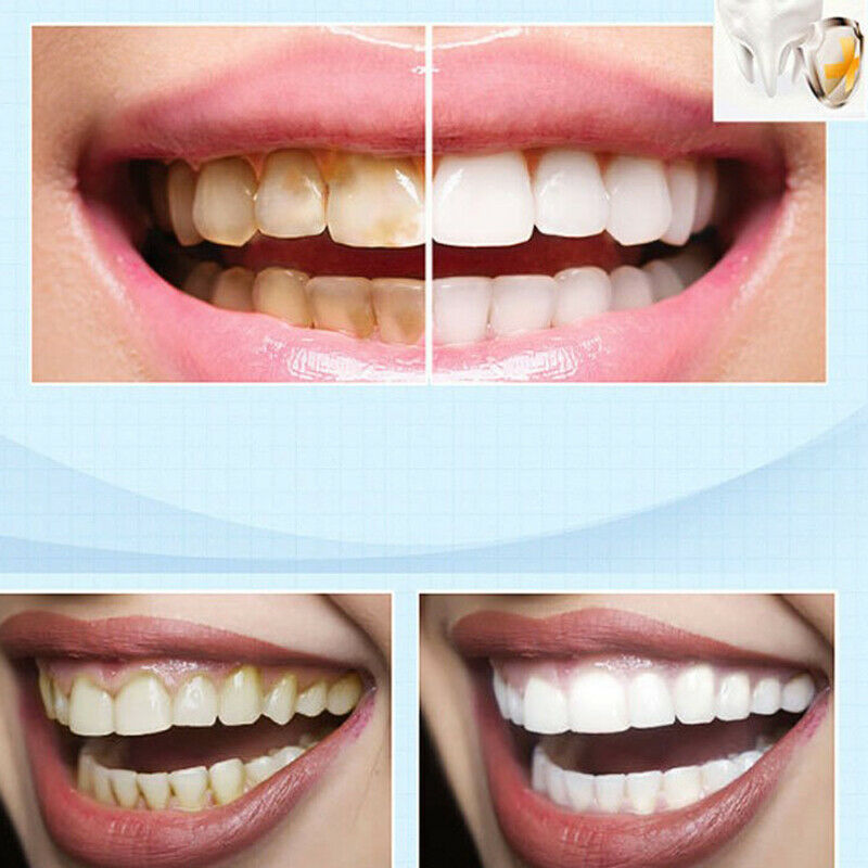 1pc Magic Natural Teeth Whitening Gel Pen Cleaning Remove Stains Care Too.l8