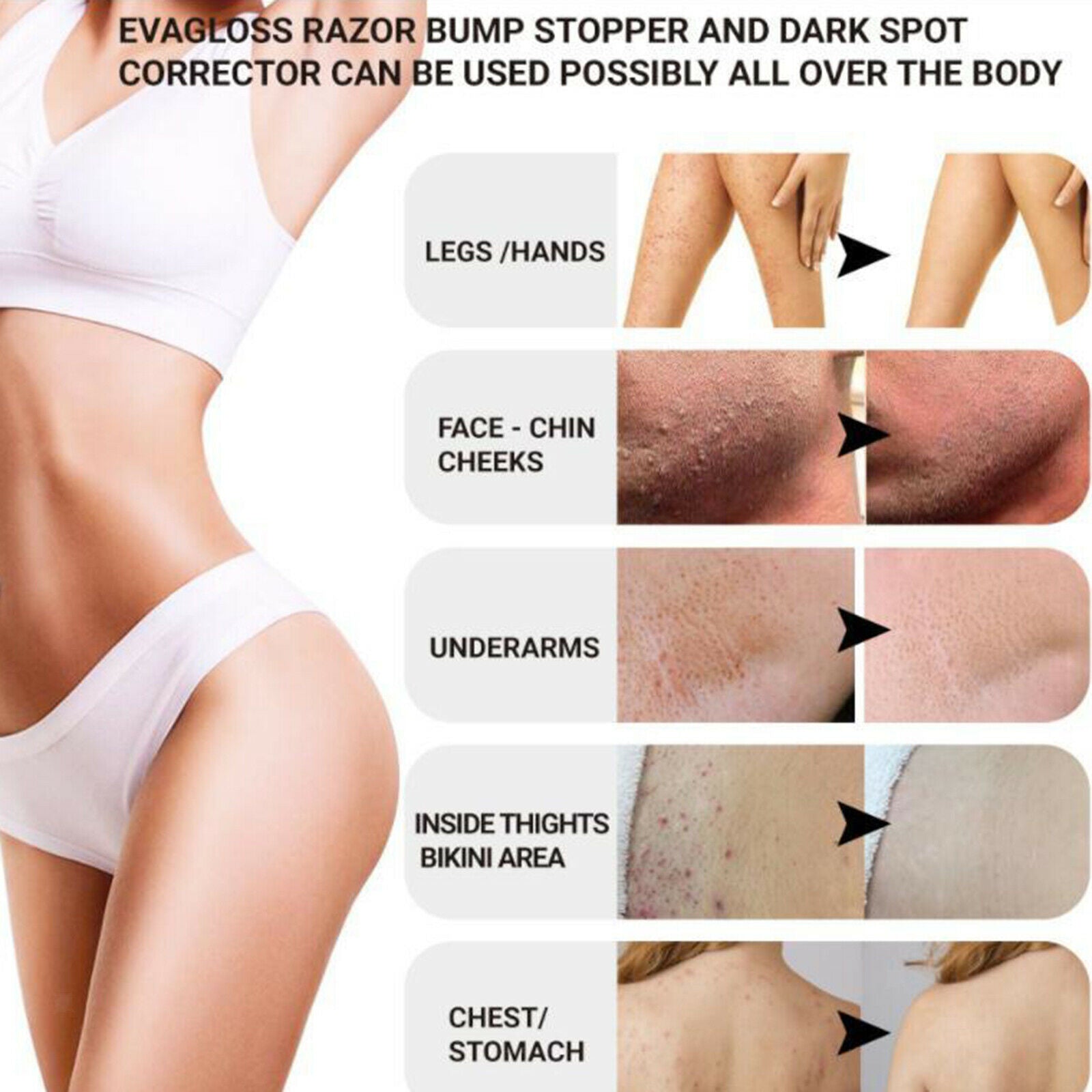 Aftershave Serum for Razor Bumps & Ingrown Hairs for Bikini Lines & Acne 100ml