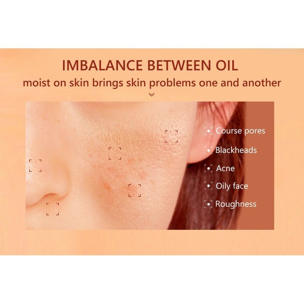 30ml Moisturizing Remove Acne facial Care Shrink Pore Minimizer Serum Salicylic