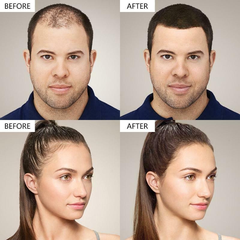 Hair Building Fibers Powder Comb Hairdressing Top Hairline Optimizer Enhancer