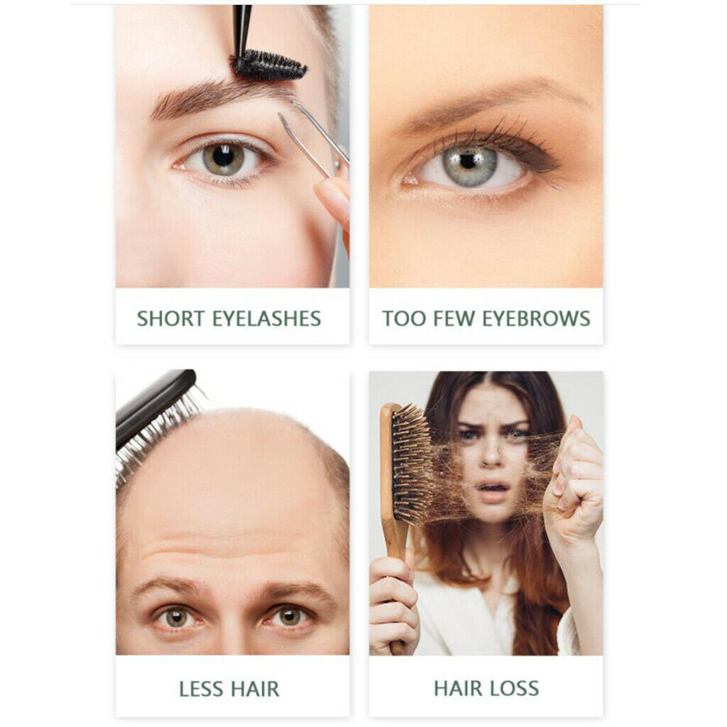 Hair Regrowth Essence Anti Hair Loss Spray Eyelashes 30ml Smooth Fuller