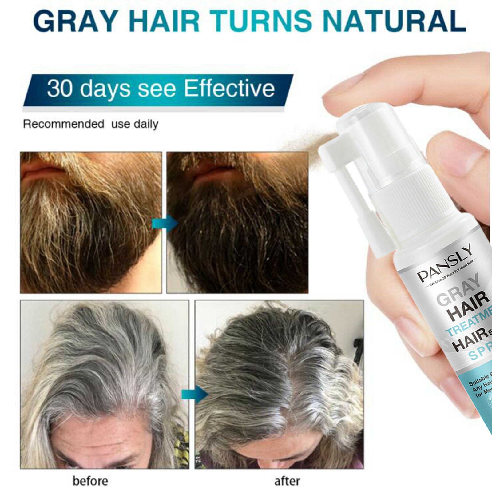 Herbal Cure White Hair Treatment Spray Beard Hair Restore Scalp Treatment