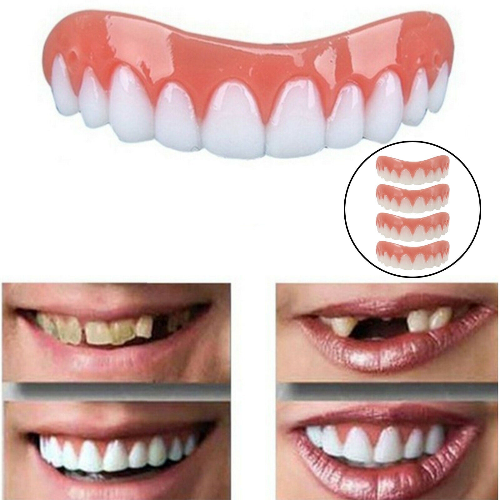 Smiling Braces Top False Teeth Veneers Tooth Covering Simulation