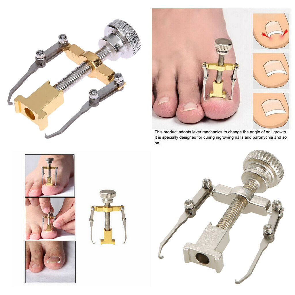 2 pcs. Professional tool for correcting ingrown toenails
